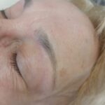 Cejas con lifting y perfilado, Mar del Plata (2)