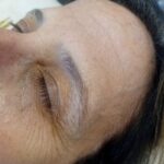 Cejas con lifting y perfilado, Mar del Plata (3)