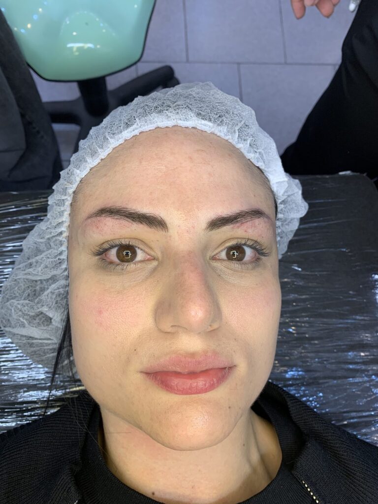 Cejas con microblading pelo a pelo, resultado (3)